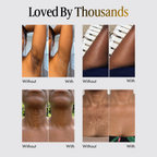 Shimma™ Black Seed Oil Body Coverage Perfector
