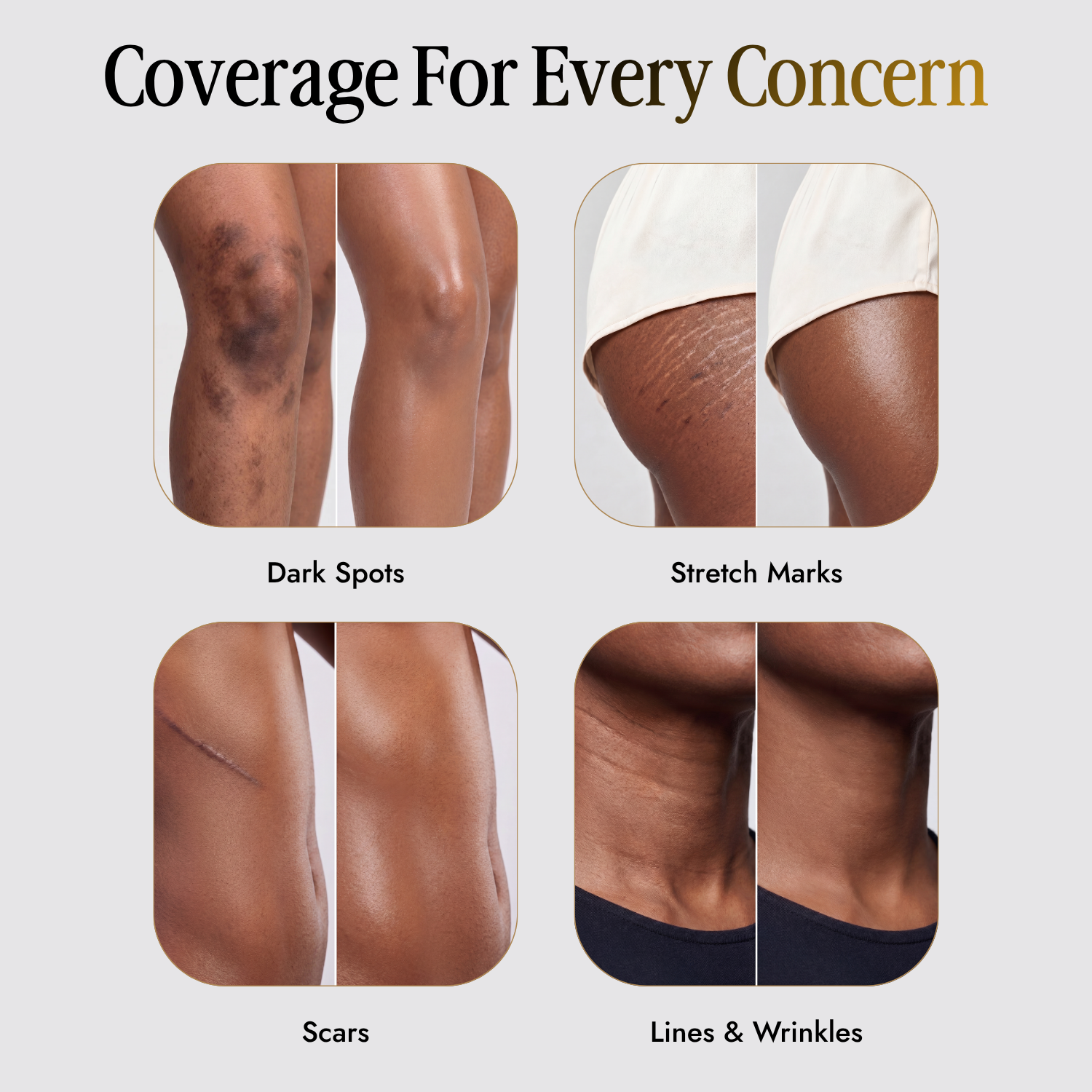 Shimma™ Black Seed Oil Body Coverage Perfector